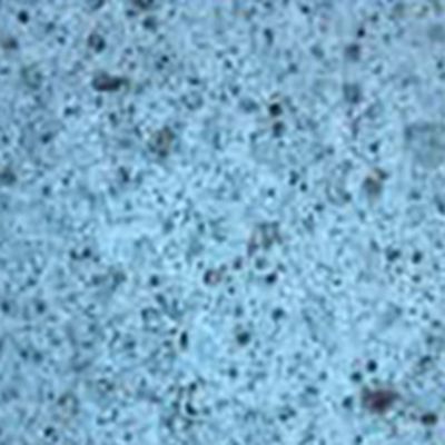 Emulsion(oil and water)